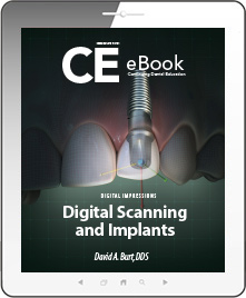 Digital Scanning and Implants eBook Thumbnail