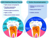 Figure 5. Benefits of 0.454% Stabilized Stannous Fluoride and Sodium Hexametaphosphate.