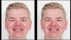 Fig 4. Side-by-side before-and-after photographs for the patient to evaluate.